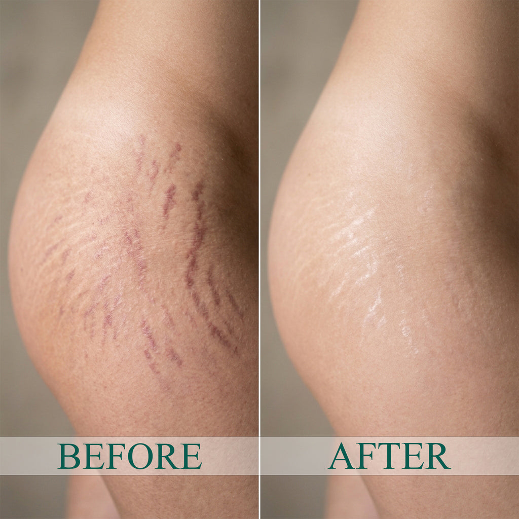 DermaFix Firm & Restore Duo