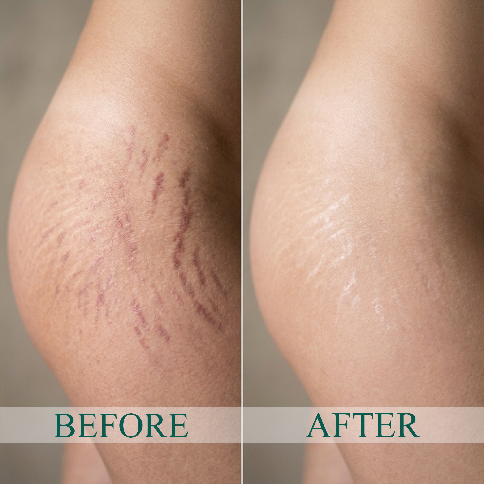 DermaFix Firm & Restore Duo